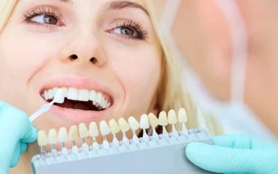 Dental Veneers: Everything you need to know