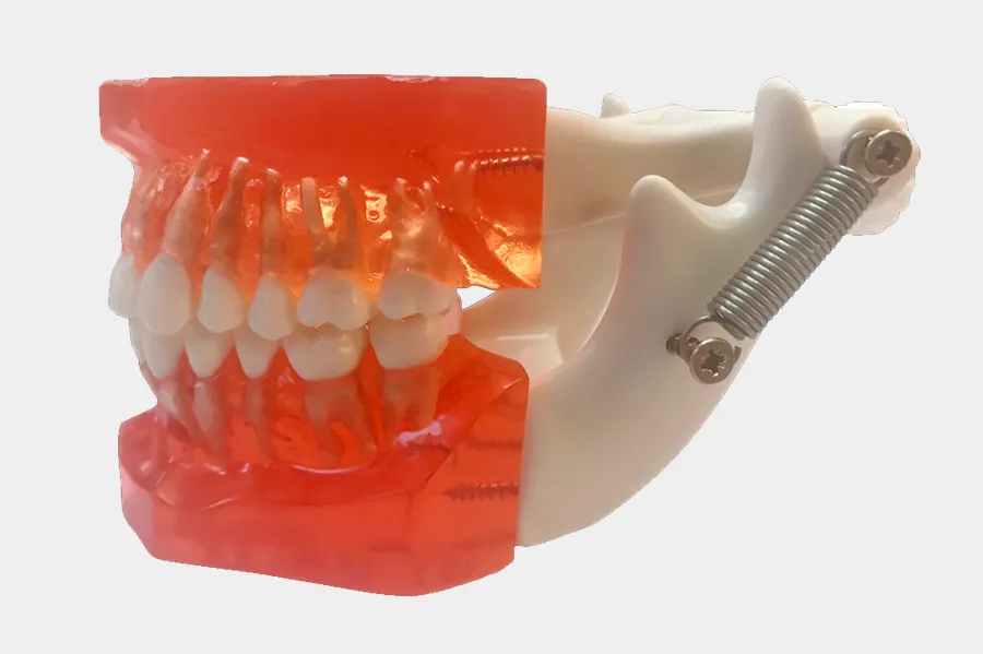 Full Mouth & Smile Rehabilitation with Orthodontics, Implants